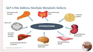GLP 1 RAs Real World Patient Care Strategies for Type 2 [upl. by Golda]