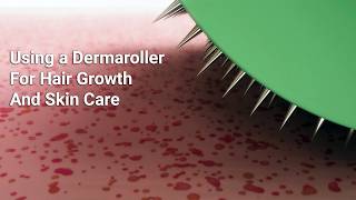 Using a DermaRoller For Hair Growth And Skin Care [upl. by Hedvige673]