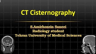 MedImag CT Cisternography [upl. by Luttrell425]