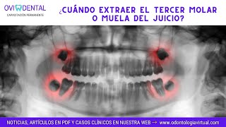 ► PERICORONARITIS ¿Cuándo extraer el tercer molar o muela del juicio [upl. by Vogeley]