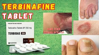 Terbinafine Tablet  Terbinafine Antifungal Drug  Terbinafine Tablets ip 250 mg [upl. by Enileuqcaj]