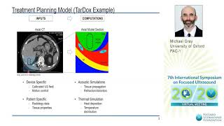 M Gray  Planning amp Delivery of Ultrasoundmediated Hyperthermia for Targeted Drug Delivery 2020 [upl. by Dulciana]