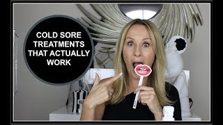 COLD SORE TREATMENTS THAT WORK  NADINE BAGGOTT [upl. by Hnahk367]