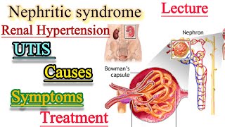 Nephritic syndromeUrinary Tract infectionsRenal Hypertensioncauses SymptomsTreatment [upl. by Lincoln]