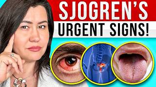 10 Signs of Sjogrens Syndrome  a very complex autoimmune disease [upl. by Va]