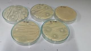 Antibiotic Sensitive Test  Procedure and their results [upl. by Jerz]