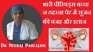 पेट में सूजन पीरियड्स में दर्द बच्चा न ठहरना का इलाज Bulky Uterus Adenomyosis [upl. by Ley]