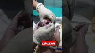 how to new baby suction suction suction baby old song jindagi ek jung haitrending viralshor [upl. by Araminta]