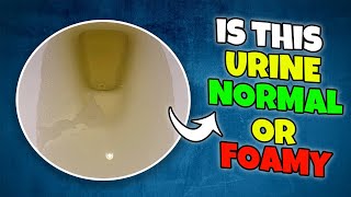 How to Know If Urine is Foamy or Normal [upl. by Nevi]