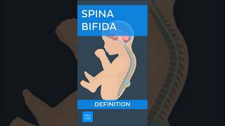 Spina bifida offener Rücken Definition  Kenhub spinabifida [upl. by Meer]