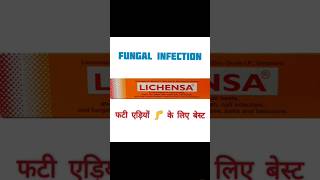 Lichensa ointment cream  का उपयोग हिंदी में medical drx doctor dpharma bpharma bams nursing [upl. by Ahrens]