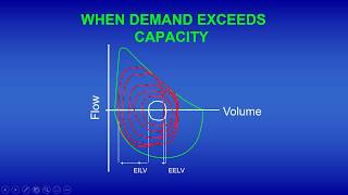 Exercise Ventilatory Limitations [upl. by Rabush]