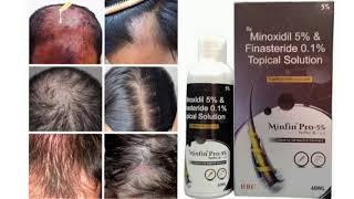 Minfin Pro 5 Topical Solution Minoxidil 5 amp Finasteride 01 Topical Solution [upl. by Liscomb243]