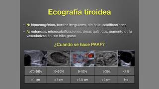 Tiroides Nódulo tiroideo y Cáncer de Tiroides [upl. by Romney660]