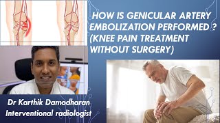 HOW IS GENICULAR ARTERY EMBOLIZATION PERFORMED  KNEE PAIN TREATMENT WITHOUT SURGERY [upl. by Stulin]