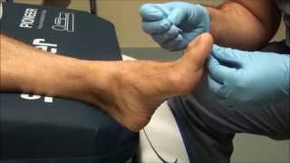 Neurologic Examination of the Foot Pin Prick Testing [upl. by Atsyrt]