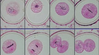 Ascaris sp MITOSIS STAGES [upl. by Bagger]