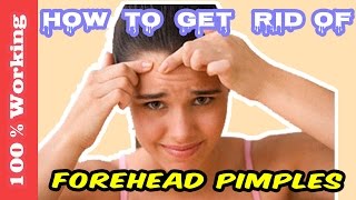 How To Get Rid Of Pimples On Forehead Overnight  Fast  Home Remedies  Blackheads  Acne  Remove [upl. by Nnaul]