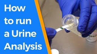 How to run a Urine Analysis [upl. by Atauqal]