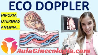 ECO DOPPLER EN OBSTETRICIA HIPOXIA ARTERIAS UTERINAS ANEMIA FETAL  Ginecología y Obstetricia [upl. by Leahcimed]