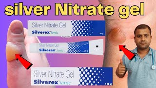 silver nitrate gel 02ww silver ionic [upl. by Koser]