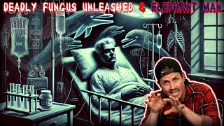 🅝🅔🅦 MrBallen Podcast ╚»💀«╝PODCAST EPISODE╚»💀«╝ Deadly Fungus Unleashed amp Elephant Man ♰ⒻⒶⓃⒻⒶⓋⓄⓇⒾⓉⒺ♰ [upl. by Erialc]