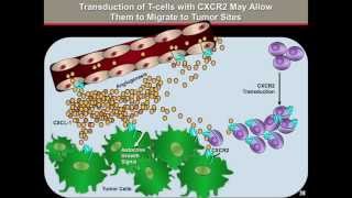 Tcell Adoptive Therapy for Melanoma  Melanoma Education Symposium Patrick Hwu MD [upl. by Adnicaj887]