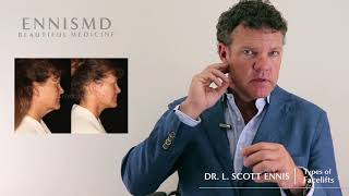 Mini vs Full Facelift Find out the difference with Dr L Scott Ennis [upl. by Spain]