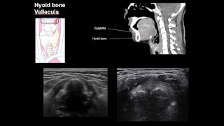 ENGNeck anatomy 1center [upl. by Feledy]