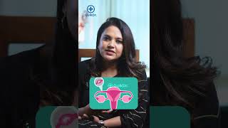 ട്യൂബിൽ വരുന്ന Pregnancy ഒരു പ്രശ്നമാണോ  Tubal Pregnancy Malayalam [upl. by Steinberg477]