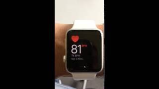 Apple Watch Heart Attack [upl. by Benjie]