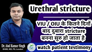 The Journey of Urethral Strictures From Diagnosis to VIU OIU to Recovery and role of homeopathy [upl. by Emmeram]