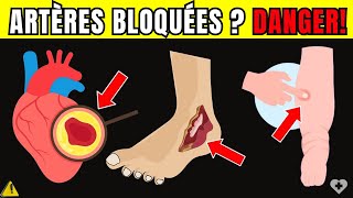 🛑Alerte Cardiaque 7 Signes dartères Bloquées Dans les Jambes et Les Pieds qui Mettent vie Danger [upl. by Ainitsirhc]