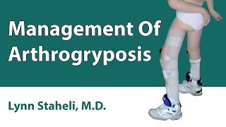 Management Of Arthrogryposis [upl. by Thomey]