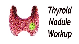 Thyroid Nodule Workup  What Happens Next Is it Cancer [upl. by Tombaugh227]