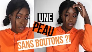 MES ASTUCES POUR UNE PEAU SANS BOUTONS  Sarahdichannel [upl. by Tait]