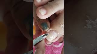 cleaning toenail client satisfy videos pedicure satisfying subscribe [upl. by Tamberg76]