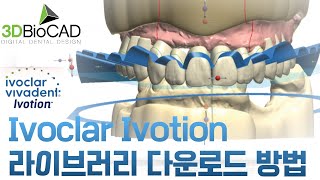 Ivoclar Ivotion 라이브러리 다운로드 방법 [upl. by Ian]