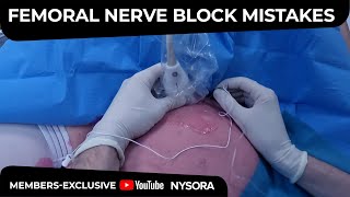 Femoral Nerve Block Common Mistakes  Crash course with Dr Hadzic [upl. by Con]