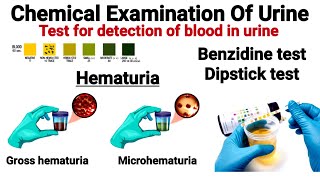 Benzidine test  Test for detection of blood in urine Hemoglobinuria  Hematuria [upl. by Groves]