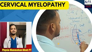 cervical myelopathy [upl. by Hairim227]