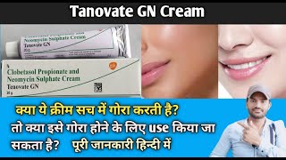 Tenovate GN Cream use benefits and Side effects full review in hindi [upl. by Adnolohs317]