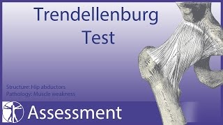 Trendelenburg Test  Hip Abductor Weakness [upl. by Murage]