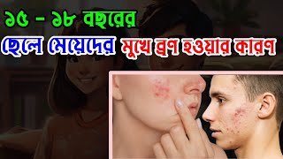 ১৫১৮ বছরের ছেলে মেয়েদের মুখে ব্রণ হওয়ার কারণমুখে ব্রণ কেন হয়। Mukhe bron hoy keno Dr Nahid Hasan [upl. by Shererd]