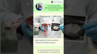 Diagnosis amp treatment of uterine fibroid doctor [upl. by Chuch]