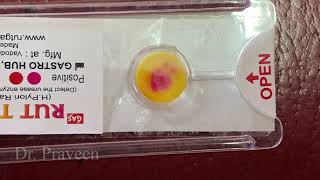 RAPID UREASE TEST FOR H PYLORI  TEST FOR GASTRITIS ULCER hpylori rutkit [upl. by Maudie]