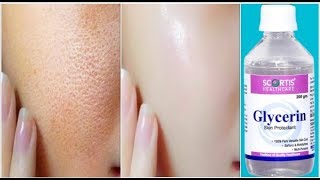 Use Glycerin This Way Your Skin Will Look So Young Tight Spotless amp Scar Free [upl. by Gnas186]