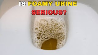 Top 5 Reasons for Foamy or Bubbly Urine [upl. by Frederiksen]