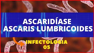 ASCARIDÍASE  ASCARIS LUMBRICOIDES LOMBRIGA  PARASITOLOGIA INFECTOLOGIA [upl. by Rehtaef]