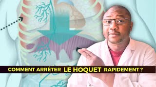 5 manières darrêter le hoquet rapidement [upl. by Ettennej]